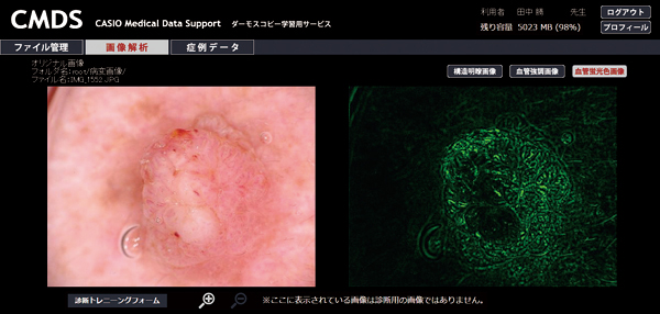 血管蛍光色画像の生成例（右側）