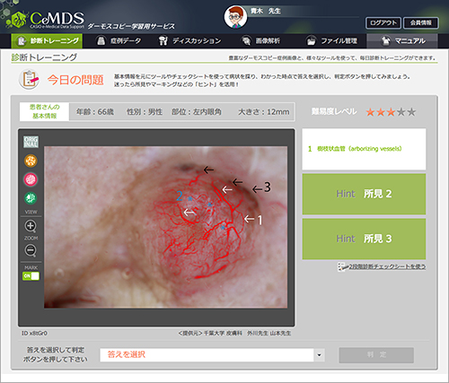 CeMDSの診断トレーニング画面例
（血管強調画像への変換後・マーキング表示）
